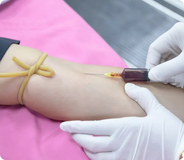 A healthcare professional wearing white gloves is drawing blood from a patient's arm using a syringe. A tourniquet is tied around the patient's arm to facilitate the procedure. The setting appears to be a clinical or home healthcare environment. Intelligent Care offers professional homecare services in Dubai, including blood sample collection.